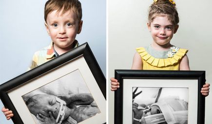 Portréty predčasne narodených detí po pôrode a dnes