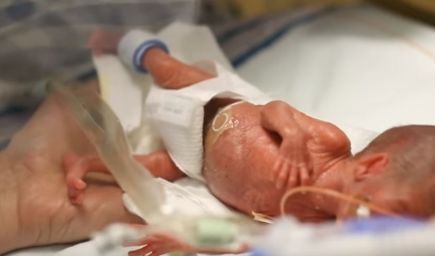 Narodeninové video predčasne narodeného Jacka dodáva nádej